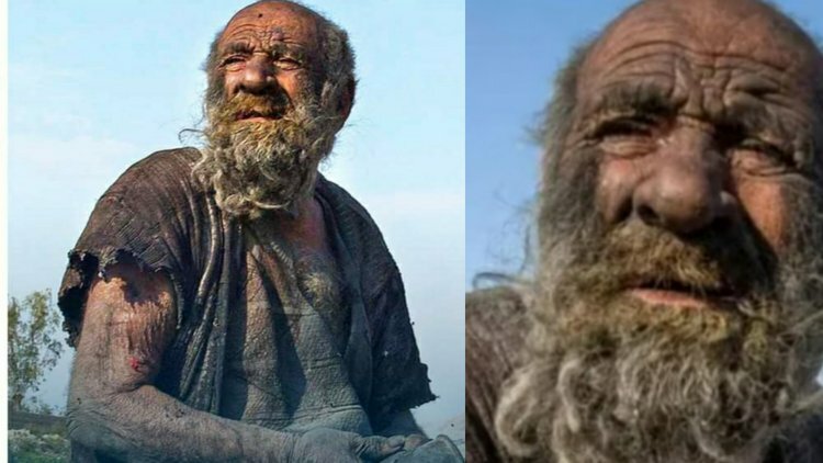 World's dirtiest man, 94, passes away after taking his first bath in more than 60 years.